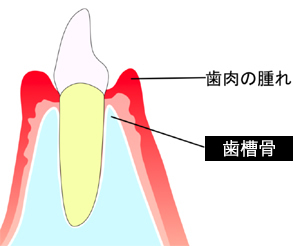 歯槽骨とは